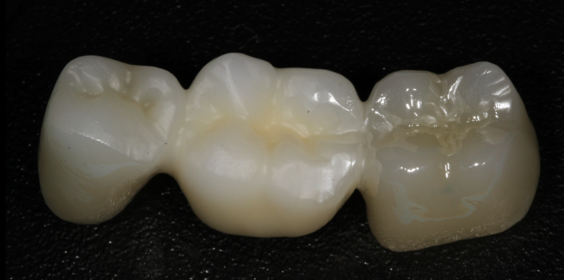 Sarı tenekede Diabrinell Premium Parlatma Pastası, Zirkopol