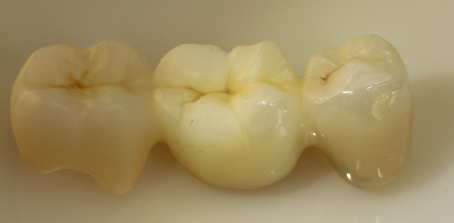 Sarı tenekede Diabrinell Premium Parlatma Pastası, Zirkopol